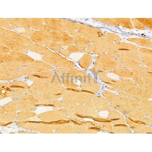 FBXO17 Antibody - DF13006 at 1/100 staining Rat skin tissue by IHC-P.