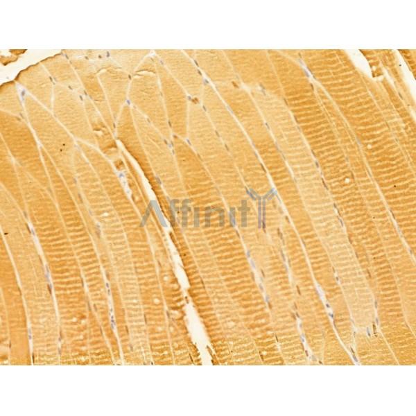 FBXO7 Antibody - DF13008 at 1/100 staining Rat muscle tissue by IHC-P.