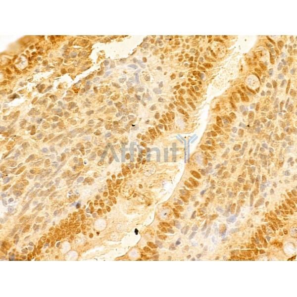FBXO7 Antibody - DF13008 at 1/100 staining Rat colon tissue by IHC-P.