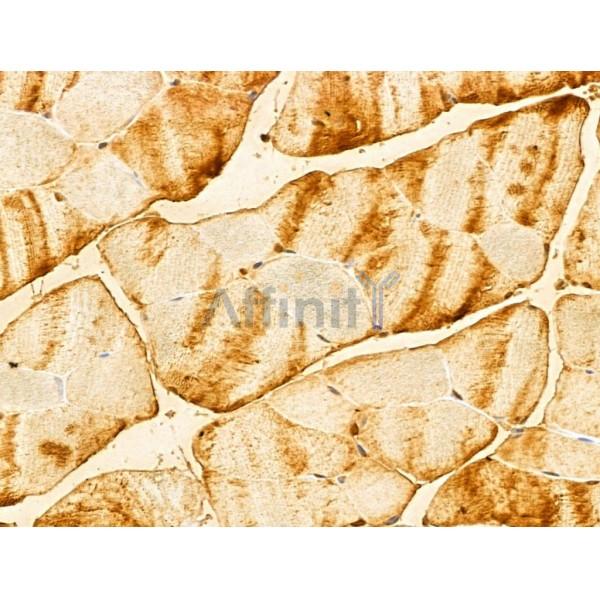 FBXO7 Antibody - DF13008 at 1/100 staining Mouse muscle tissue by IHC-P.