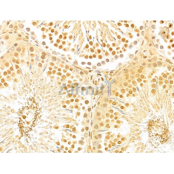 FBXO7 Antibody - DF13008 at 1/100 staining Rat testis tissue by IHC-P.