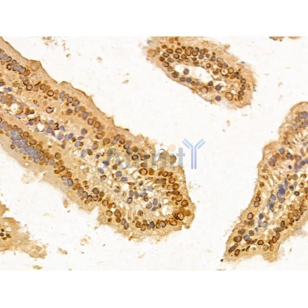 FBXW2 Antibody - DF13010 at 1/100 staining Mouse colon tissue by IHC-P.