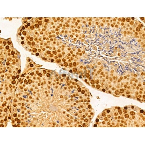 FBXW2 Antibody - DF13010 at 1/100 staining Mouse testis tissue by IHC-P.