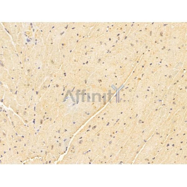 FBXW2 Antibody - DF13010 at 1/100 staining Mouse heart tissue by IHC-P.