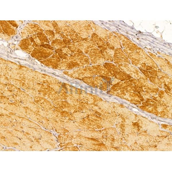 FERMT1 Antibody - DF13012 at 1/100 staining Rat skin tissue by IHC-P.