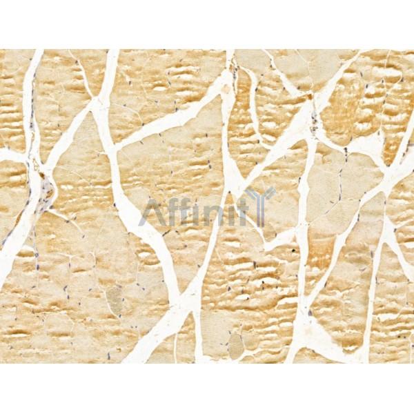 FKBP14 Antibody - DF13016 at 1/100 staining Mouse muscle tissue by IHC-P.
