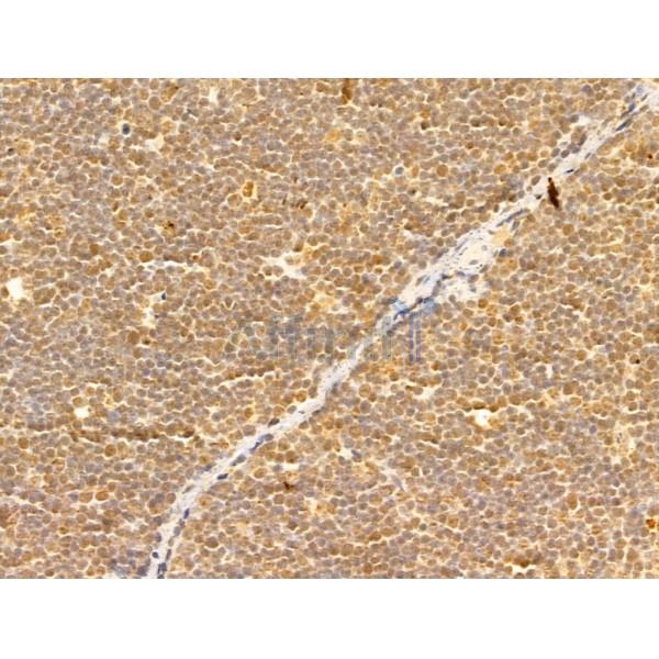 FMN2 Antibody - DF13017 at 1/100 staining Rat thymus tissue by IHC-P.