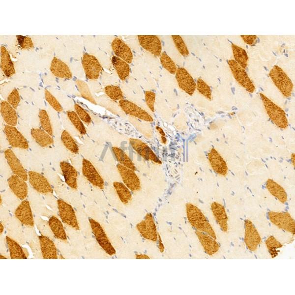 FOXRED1 Antibody - DF13021 at 1/100 staining Rat muscle tissue by IHC-P.