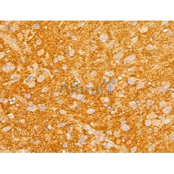 Fukutin Antibody - DF13024 at 1/100 staining Rat brain tissue by IHC-P.