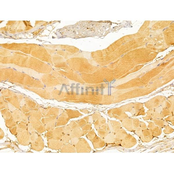 Fukutin Antibody - DF13024 at 1/100 staining Mouse skin tissue by IHC-P.