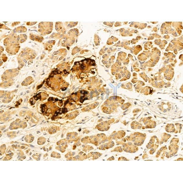 Fukutin Antibody - DF13024 at 1/100 staining Human normal tissues adjacent to esophageal cancer by IHC-P.