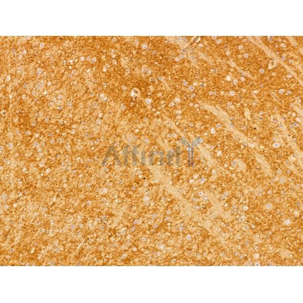 Fukutin Antibody - DF13024 at 1/100 staining Mouse brain tissue by IHC-P.