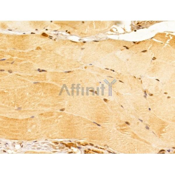 FZR1 Antibody - DF13027 at 1/100 staining Mouse skin tissue by IHC-P.