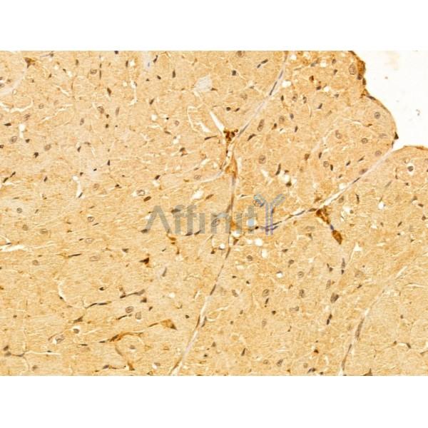 FZR1 Antibody - DF13027 at 1/100 staining Mouse heart tissue by IHC-P.