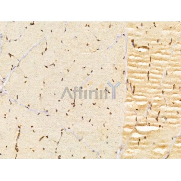 FZR1 Antibody - DF13027 at 1/100 staining Rat skin tissue by IHC-P.