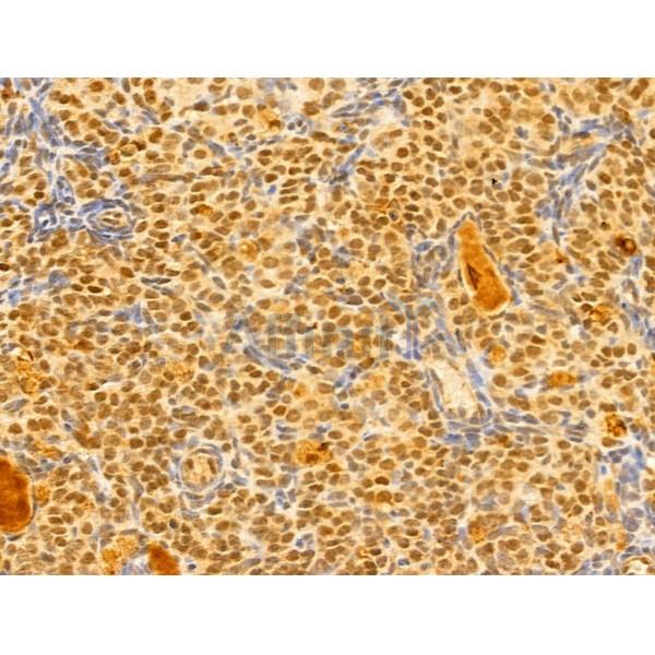 GABPB1 Antibody - DF13029 at 1/100 staining Mouse ovary tissue by IHC-P.