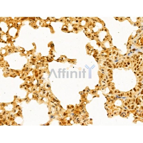 GABPB1 Antibody - DF13029 at 1/100 staining Mouse lung tissue by IHC-P.