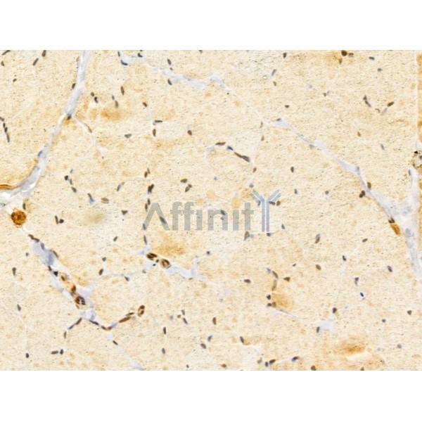 GABPB1 Antibody - DF13029 at 1/100 staining Rat skin tissue by IHC-P.