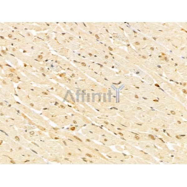 GABPB1 Antibody - DF13029 at 1/100 staining Rat heart tissue by IHC-P.