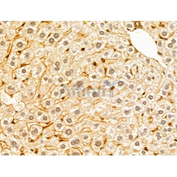 GABPB1 Antibody - DF13029 at 1/100 staining Mouse liver tissue by IHC-P.