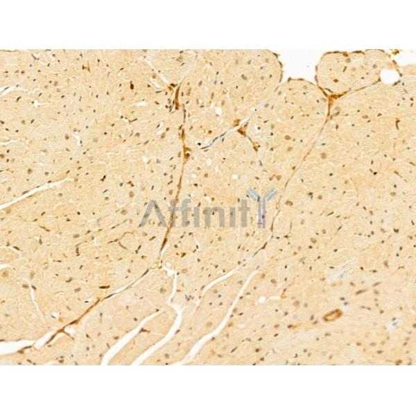 GABPB1 Antibody - DF13029 at 1/100 staining Mouse heart tissue by IHC-P.