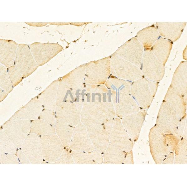 GABPB1 Antibody - DF13029 at 1/100 staining Mouse muscle tissue by IHC-P.