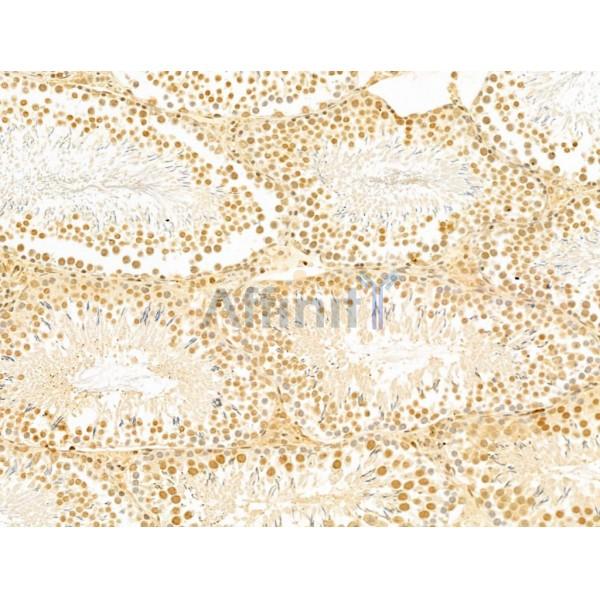 GABPB1 Antibody - DF13029 at 1/100 staining Rat testis tissue by IHC-P.