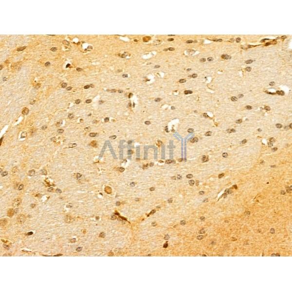 GABPB1 Antibody - DF13029 at 1/100 staining Mouse brain tissue by IHC-P.