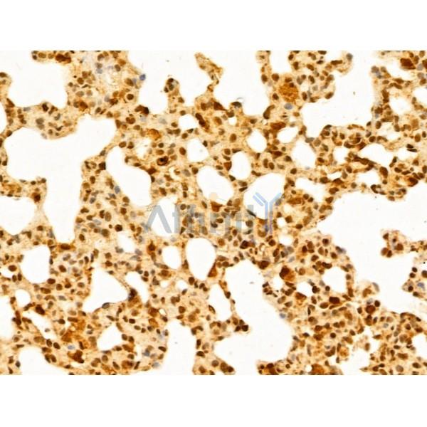 GABPB1 Antibody - DF13029 at 1/100 staining Rat lung tissue by IHC-P.