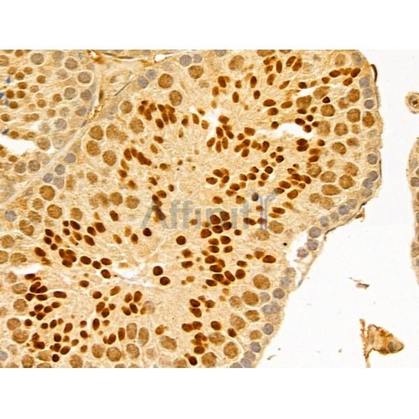 GABPB1 Antibody - DF13029 at 1/100 staining Mouse testis tissue by IHC-P.