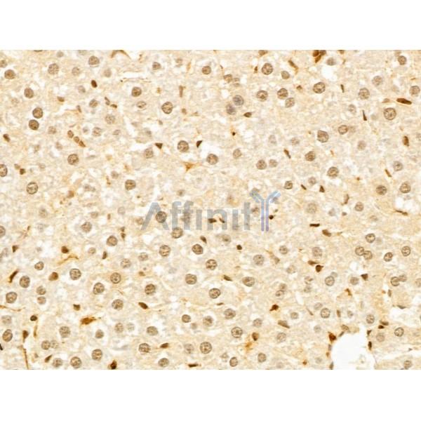 GABPB1 Antibody - DF13029 at 1/100 staining Rat liver tissue by IHC-P.