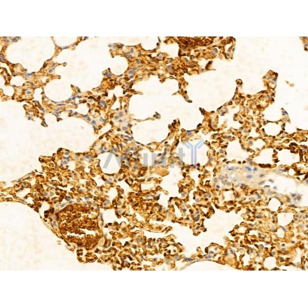 GCHFR Antibody - DF13035 at 1/100 staining Mouse lung tissue by IHC-P.