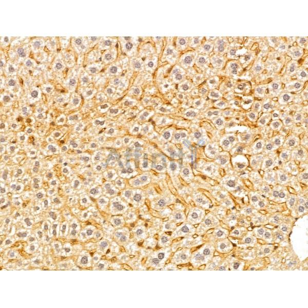 GGCT Antibody - DF13037 at 1/100 staining Mouse liver tissue by IHC-P.
