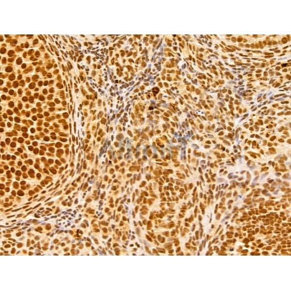 GINS3 Antibody - DF13039 at 1/100 staining Mouse ovary tissue by IHC-P.
