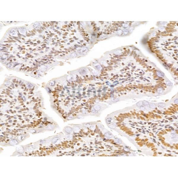 GINS3 Antibody - DF13039 at 1/100 staining Rat colon tissue by IHC-P.