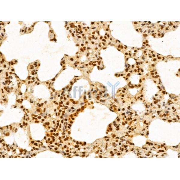 GINS3 Antibody - DF13039 at 1/100 staining Rat lung tissue by IHC-P.