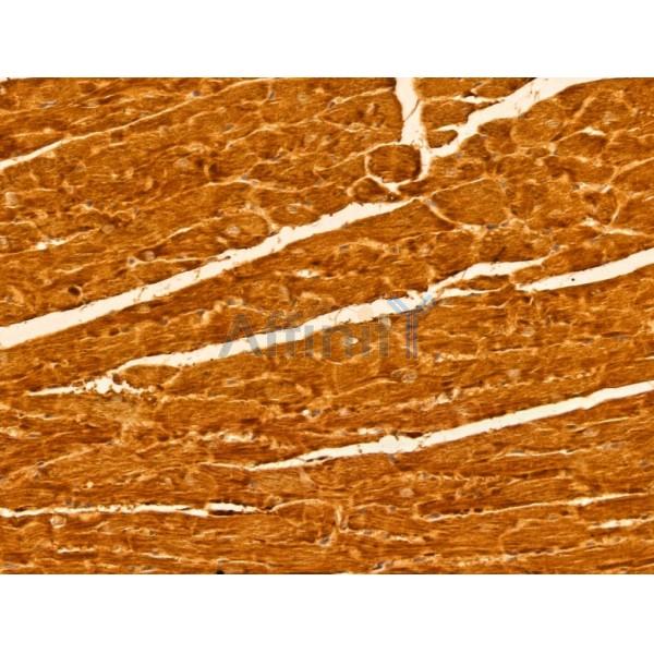 GLOD4 Antibody - DF13040 at 1/100 staining Mouse heart tissue by IHC-P.