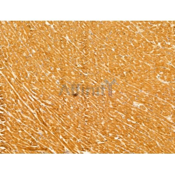 GLOD4 Antibody - DF13040 at 1/100 staining Rat heart tissue by IHC-P.