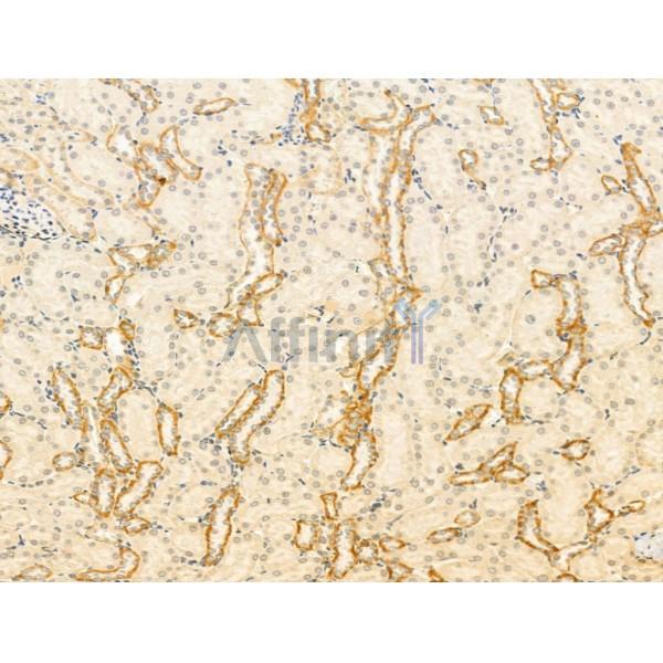 GPR177 Antibody - DF13051 at 1/100 staining Rat kidney tissue by IHC-P.