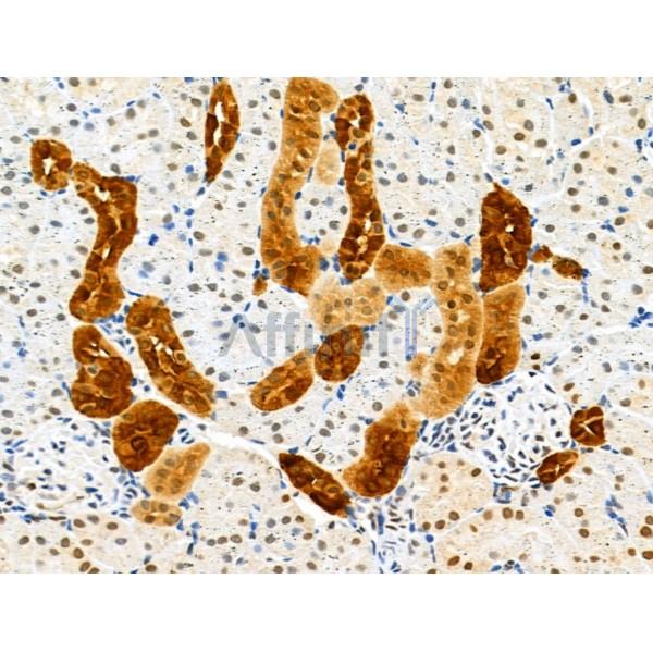 GPX8 Antibody - DF13052 at 1/100 staining Rat kidney tissue by IHC-P.
