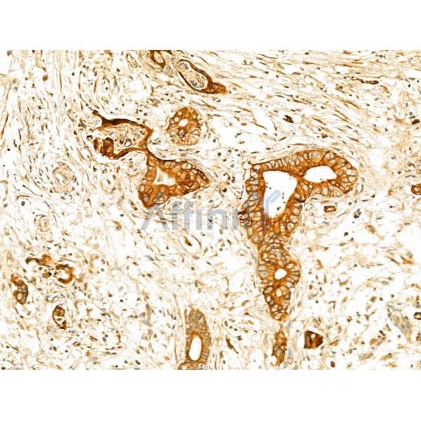 GPX8 Antibody - DF13052 at 1/100 staining Human normal tissues adjacent to pancreatic cancer by IHC-P.