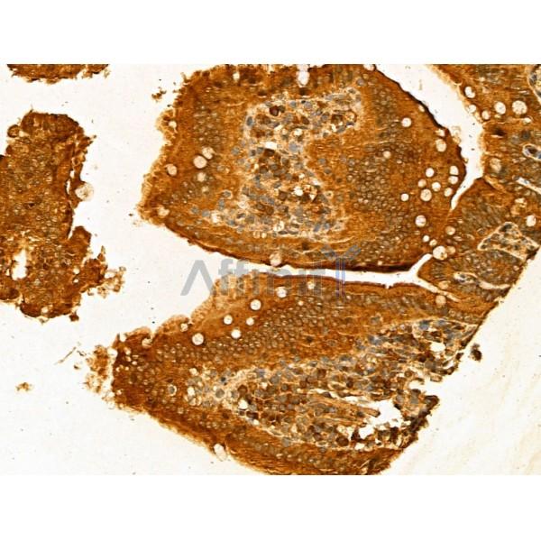Harmonin Antibody - DF13054 at 1/100 staining Mouse colon tissue by IHC-P.