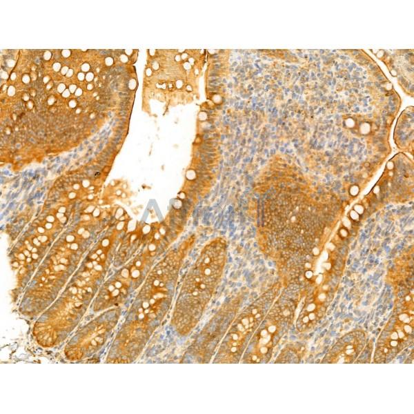 Harmonin Antibody - DF13054 at 1/100 staining Rat colon tissue by IHC-P.