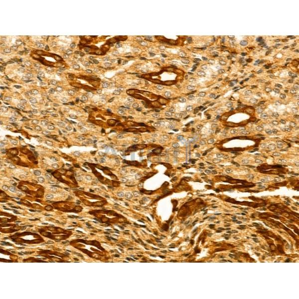HERPUD2 Antibody - DF13059 at 1/100 staining Rat kidney tissue by IHC-P.