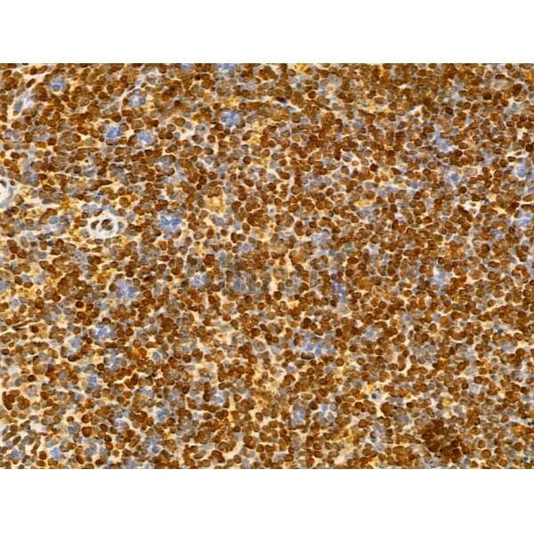 HIST1H1T Antibody - DF13061 at 1/100 staining Mouse spleen tissue by IHC-P.