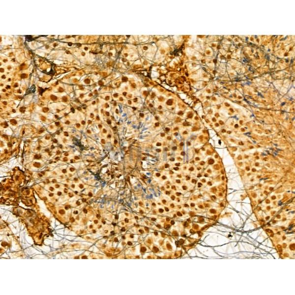 HIST1H1T Antibody - DF13061 at 1/100 staining Mouse testis tissue by IHC-P.