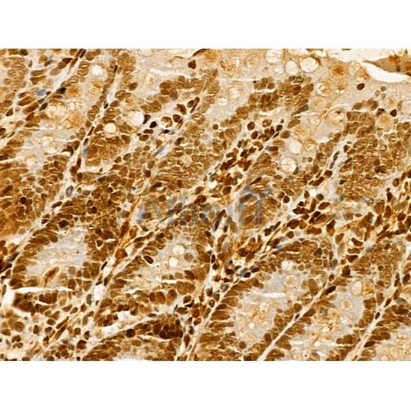 HNRNPH3 Antibody - DF13064 at 1/100 staining Rat colon tissue by IHC-P.