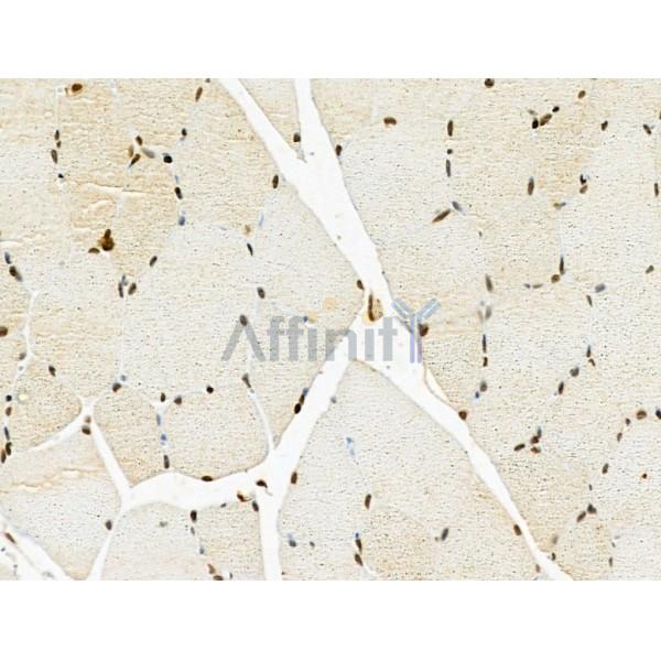 HNRNPH3 Antibody - DF13064 at 1/100 staining Rat muscle tissue by IHC-P.