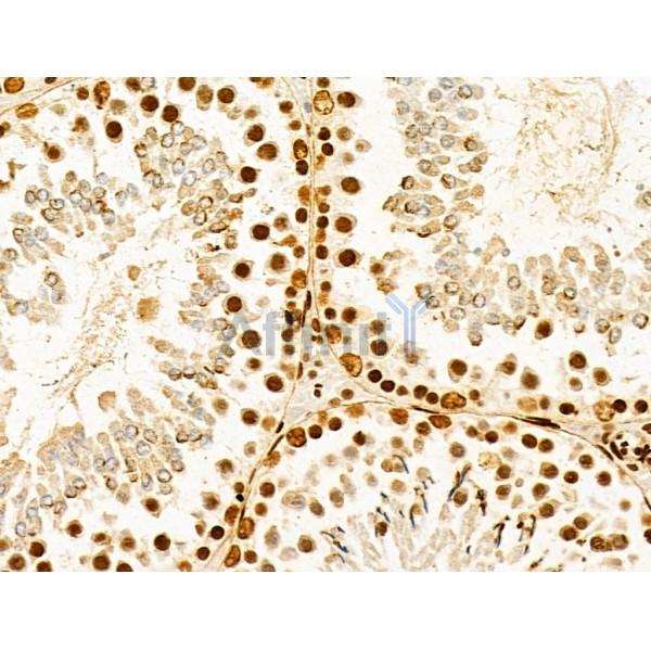 HNRNPH3 Antibody - DF13064 at 1/100 staining Rat testis tissue by IHC-P.