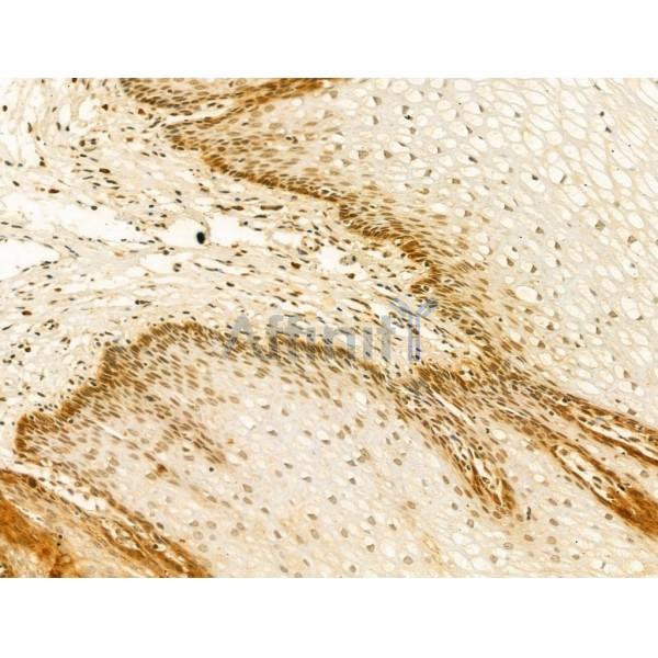 HNRNPR Antibody - DF13065 at 1/100 staining Human normal tissues adjacent to esophageal cancer by IHC-P.